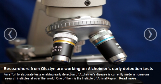 Alzheimer's early detection tests