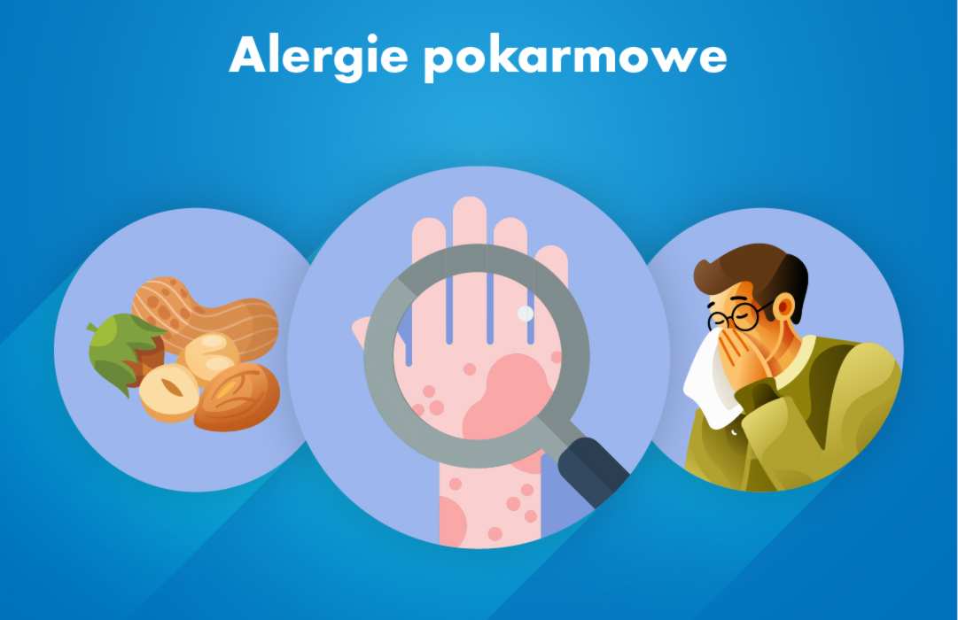 alergie